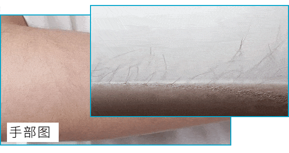 浓密的腋毛 毛手毛脚= 活脱脱的女汉子!