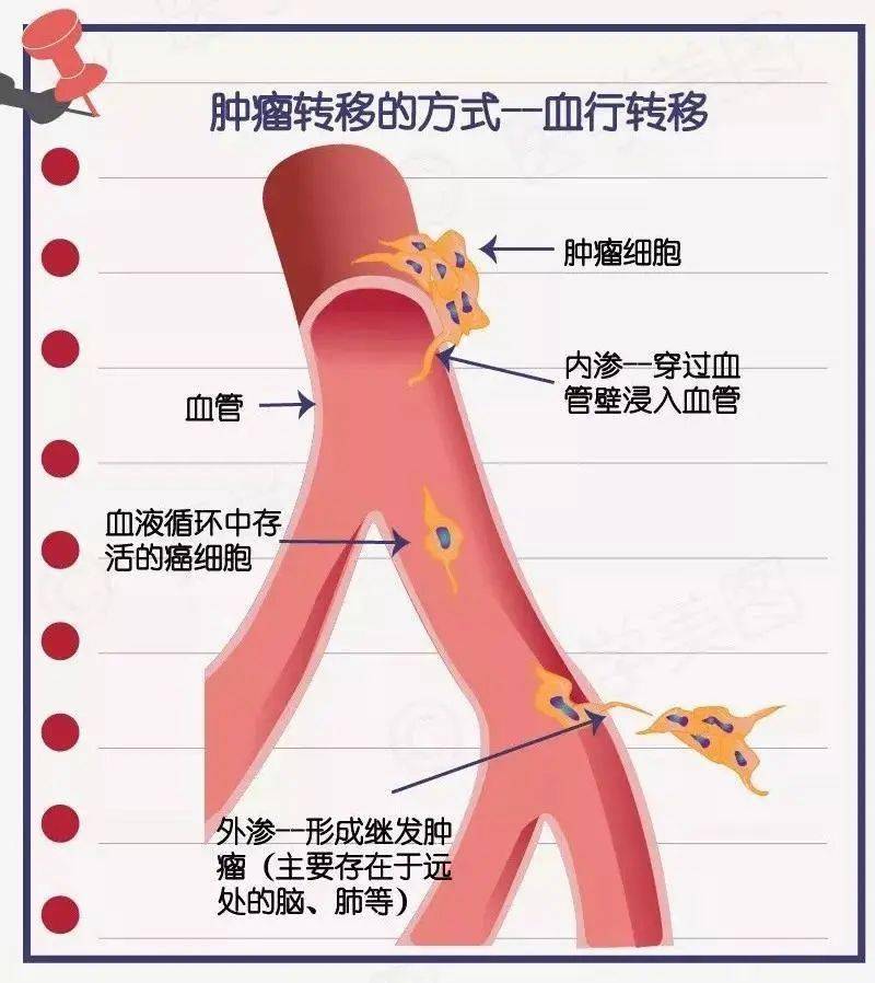 十大症状有哪些_症状有哪些_痛痹的主要症状有