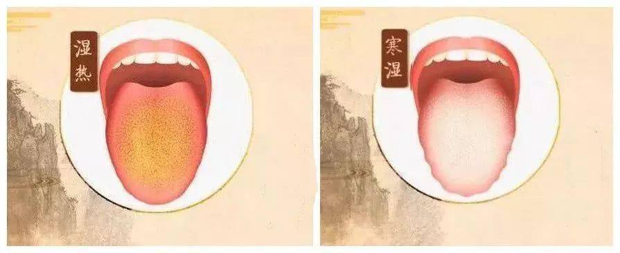 第二种:寒湿特点:舌质偏红,舌苔黄腻,小便黄,易长湿疹,怕热等!