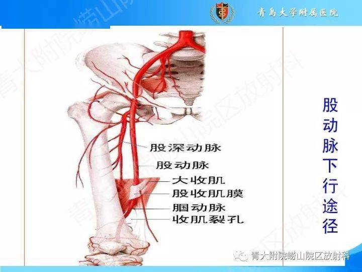 小儿左右股动脉位置图图片