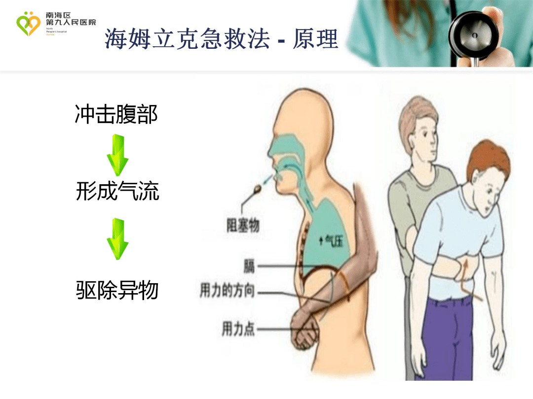 海姆立克急救法幫到你!