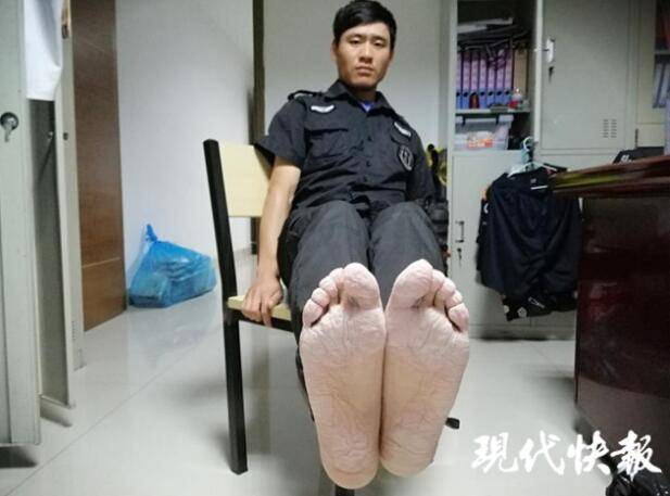 日行3万步,28岁南京小伙子这泡皱的双脚让人心疼!