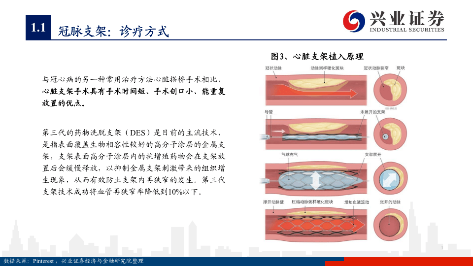 器械系列深度红海泛舟冠脉支架迭代中持续成长的市场