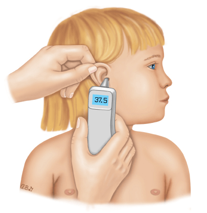 耳温测量示意图(图片来源:uptodate)