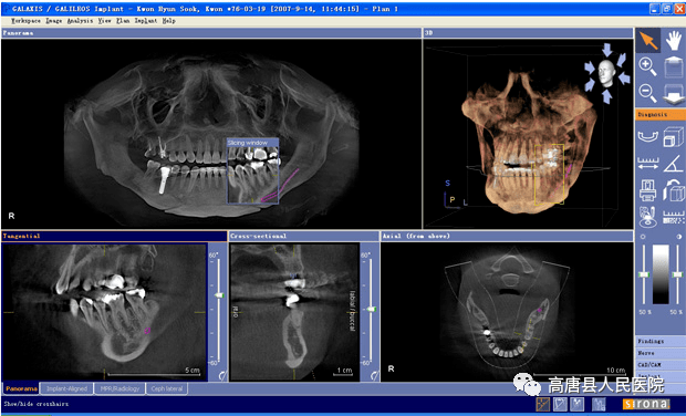 高唐县人民医院先进设备八西诺德orthophosxgsirona口腔ct