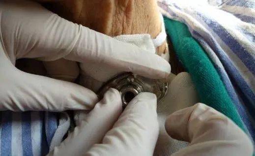 喉癌患者气管套管的护理