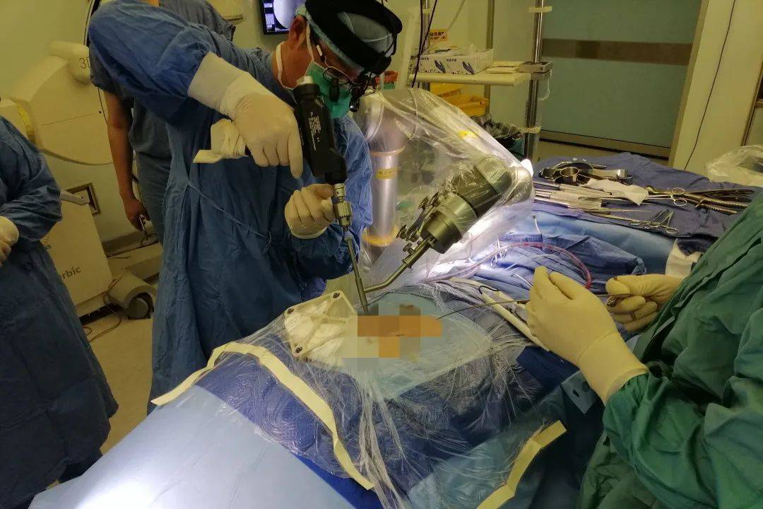 脊柱侧弯矫正手术 来自搜狐网