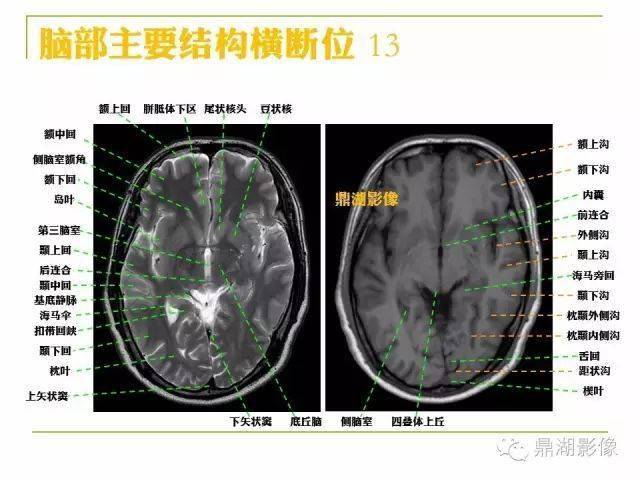 头部详细断层解剖