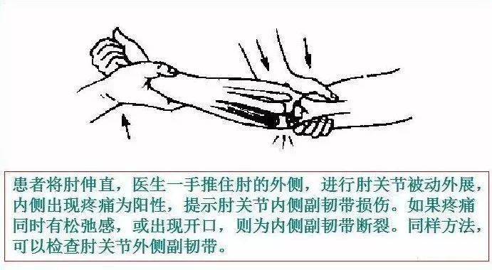 运动损伤检查及处理方法,非常实用!_试验