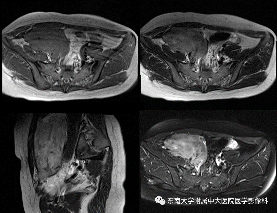 0812 泌尿生殖系统疾病