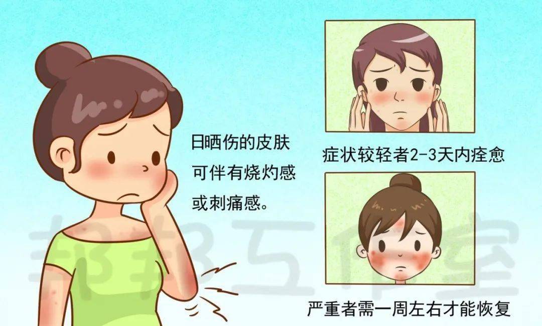 皮肤晒伤了该如何拯救