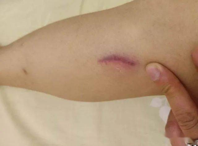 岳阳一男子路遇交警查车掉头就跑,强行冲卡撞伤辅警