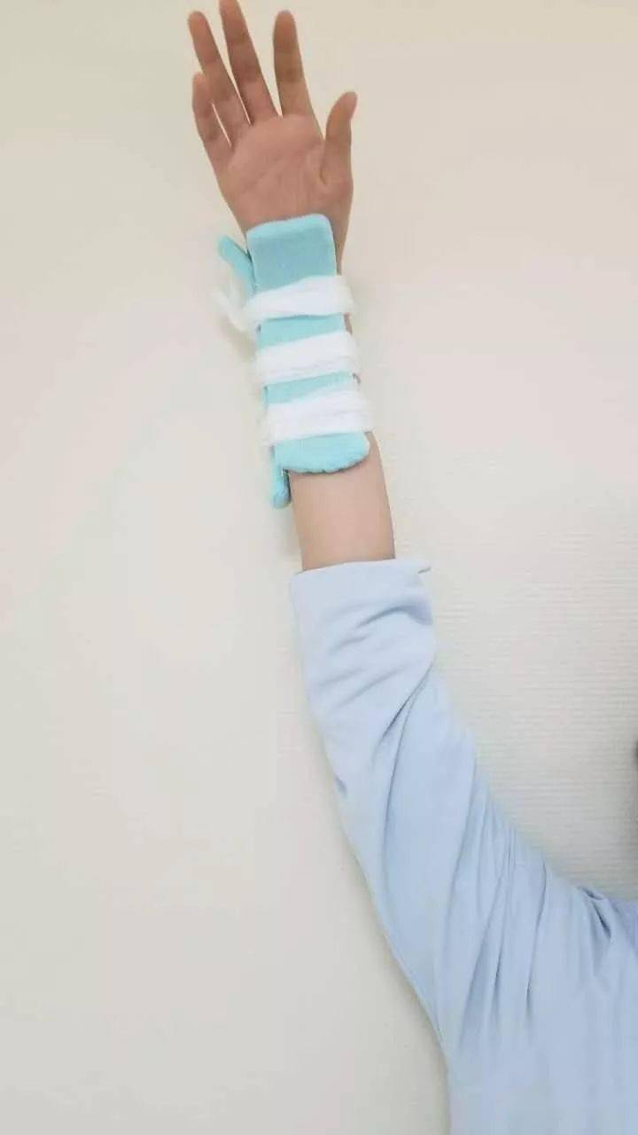 骨折后小夹板固定记住这九点,保你妥妥的._手机搜狐网