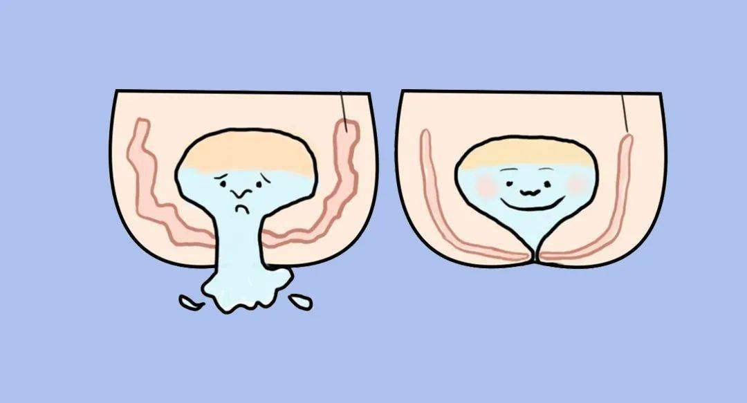 女性最该练的肌肉是盆底肌泌尿肛肠妇科都跟它有关