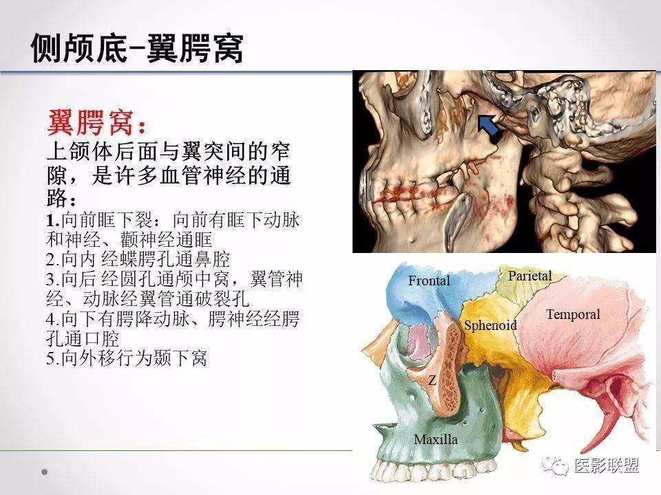侧颅底临床解剖和影像