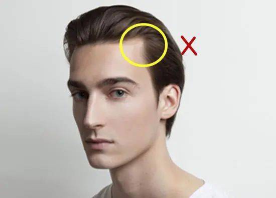 中间形成类似于美人尖的突出,这种发际线的男生具有标准帅气的额头