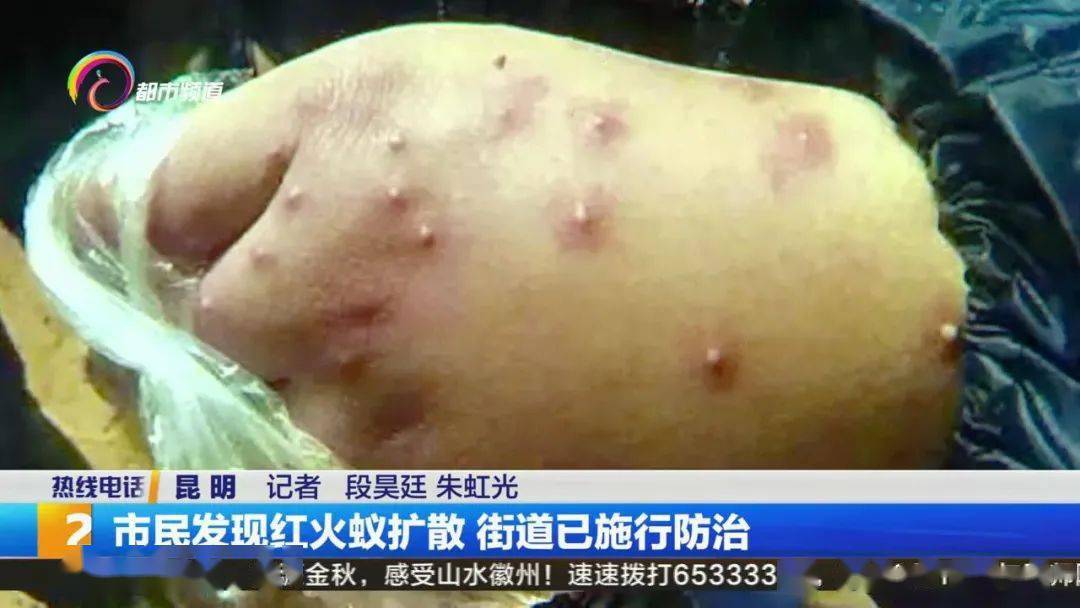 紧急提醒昆明市民发现红火蚁扩散被咬后果很严重▏fm887关注