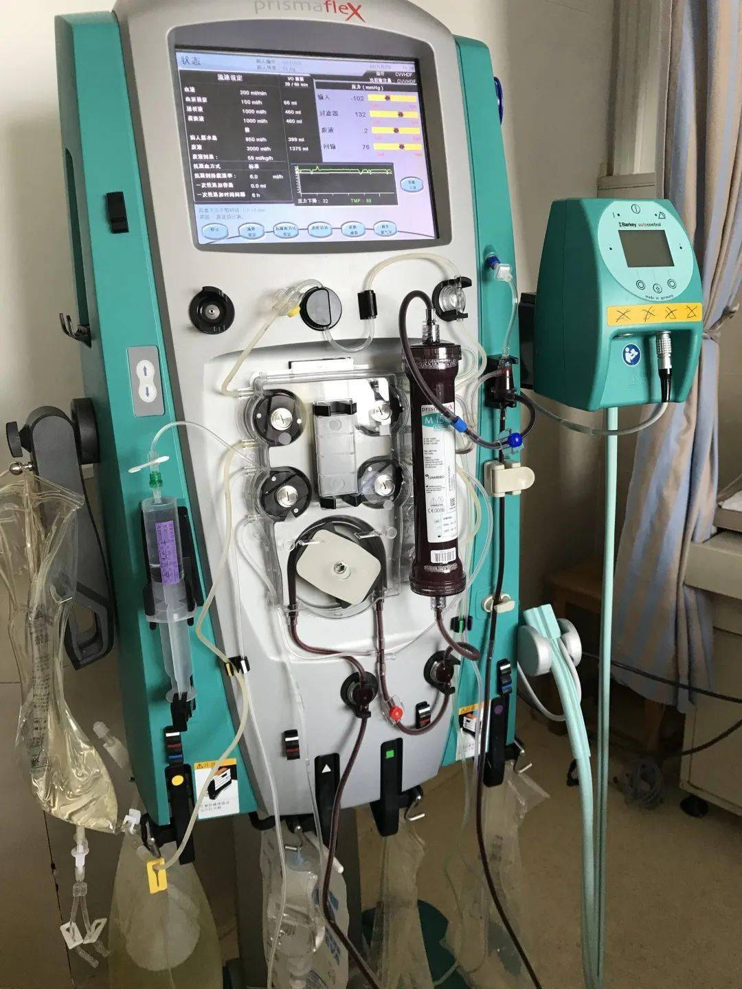 新闻嘉兴一院肾内科率先全市开展床边crrt治疗