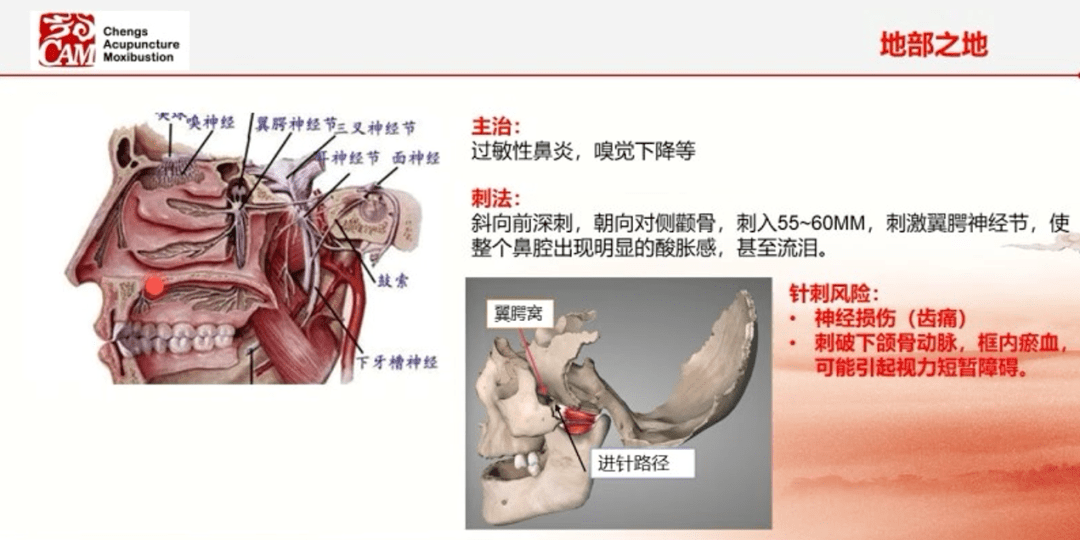 下關穴三才針刺方法居然有如此神效