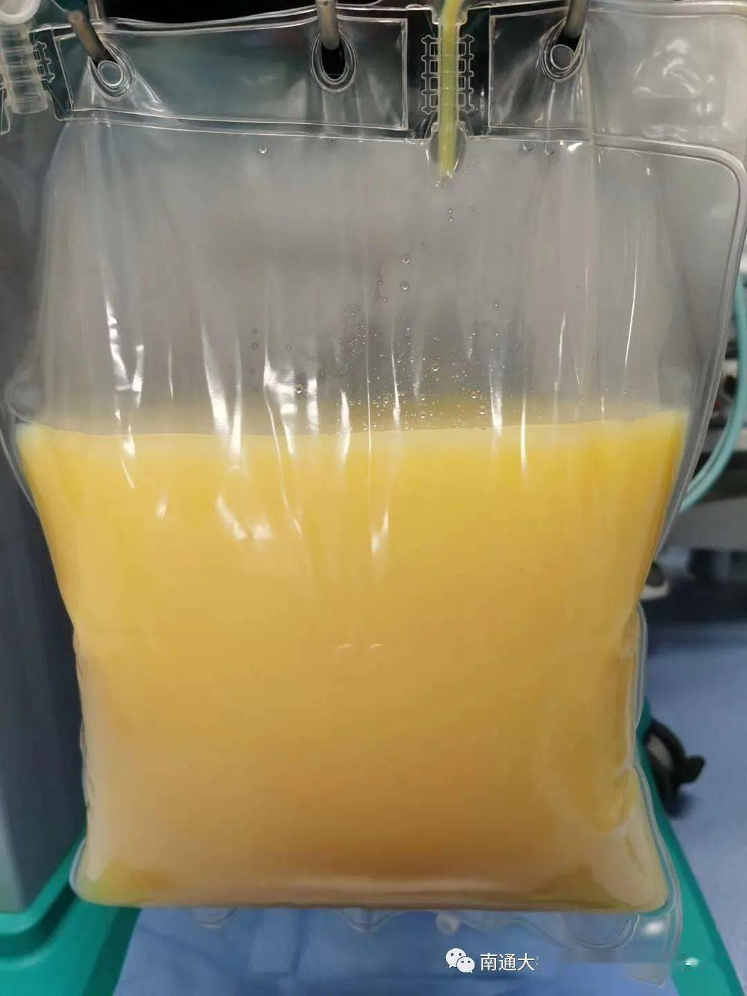 危险血液中流淌的厚厚油脂