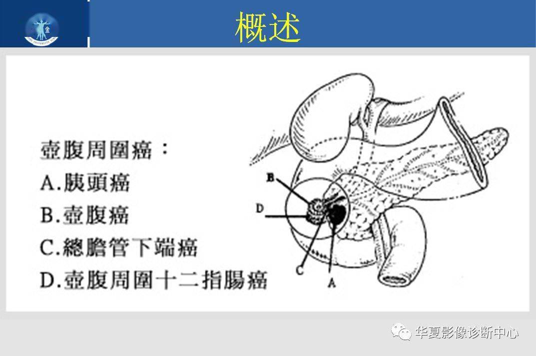 胆囊壶腹部图片