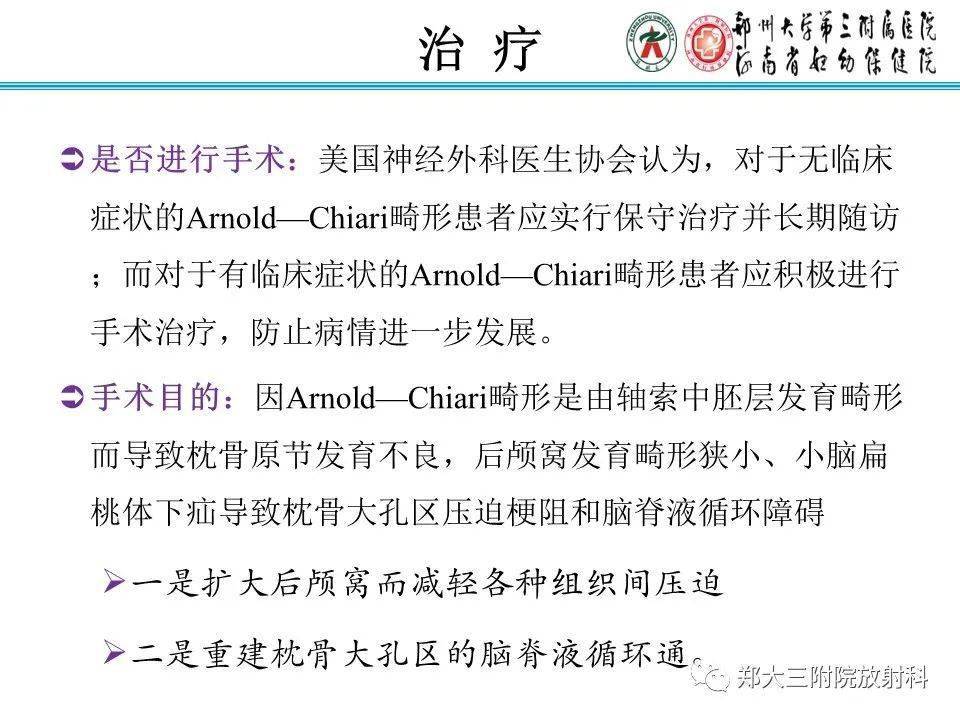 小腦扁桃體下疝畸形chiari畸形