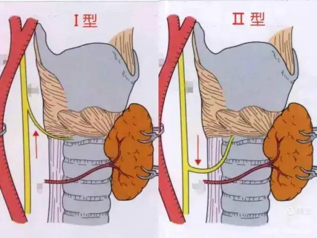 【科普】迷途知返之喉不返