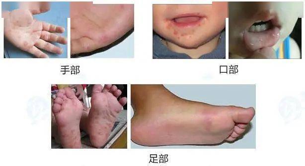 健康防护早行动