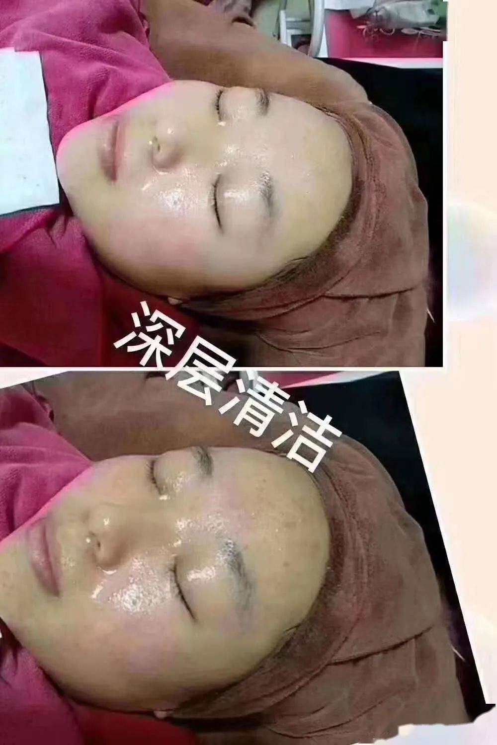 维娜三层清洁,不伤皮肤的清洁产品,肌肤毒素垃圾全排除!