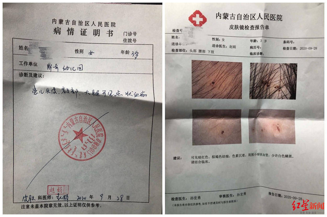 内蒙古自治区人民医院出具的检查资料
