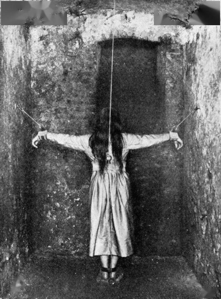 看起来像恐怖片,但这就是19世纪德国治疗精神疾病的方法