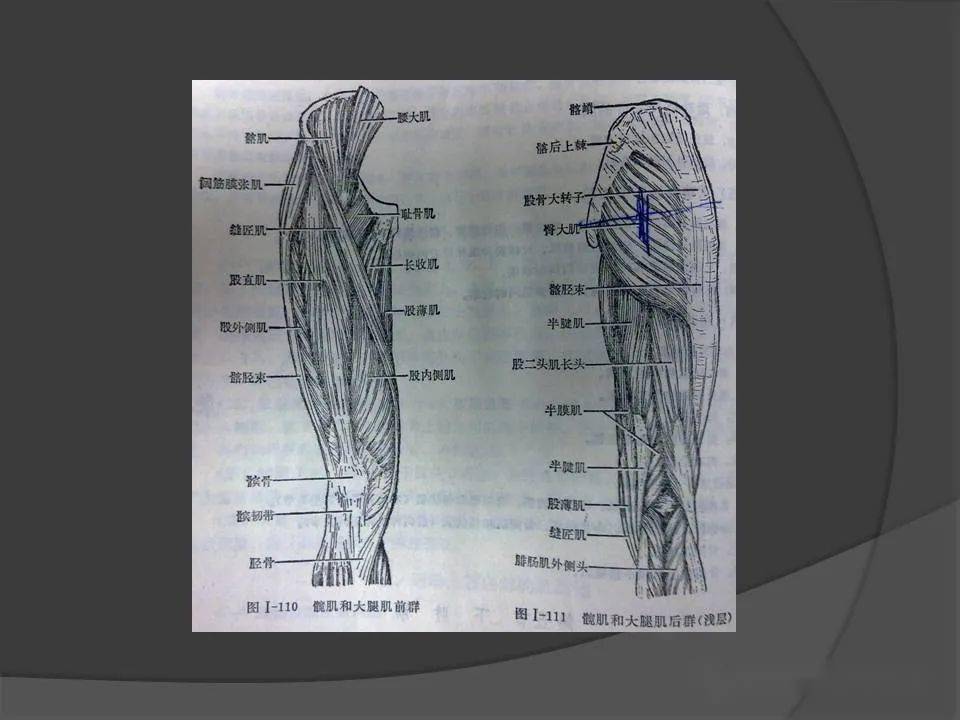 骨盆肌肉mri断层解剖