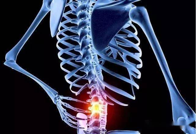 腰椎间盘突出,指的是腰椎间盘各部分包括髓核,纤维环和软骨板三部分在