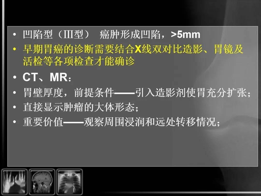 位置,移动度改变1)外压:纵膈,腹腔肿瘤 肝左叶占位 胰头癌2)本身粘连