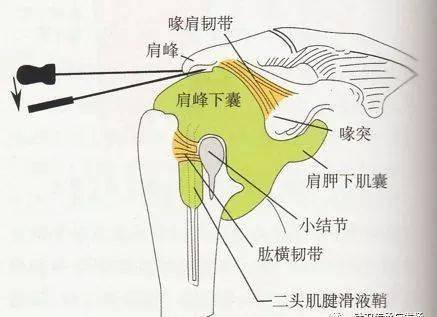 肩峰滑囊位置图片