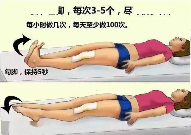 你知道吗?预防血栓,要谨记一个"动"字