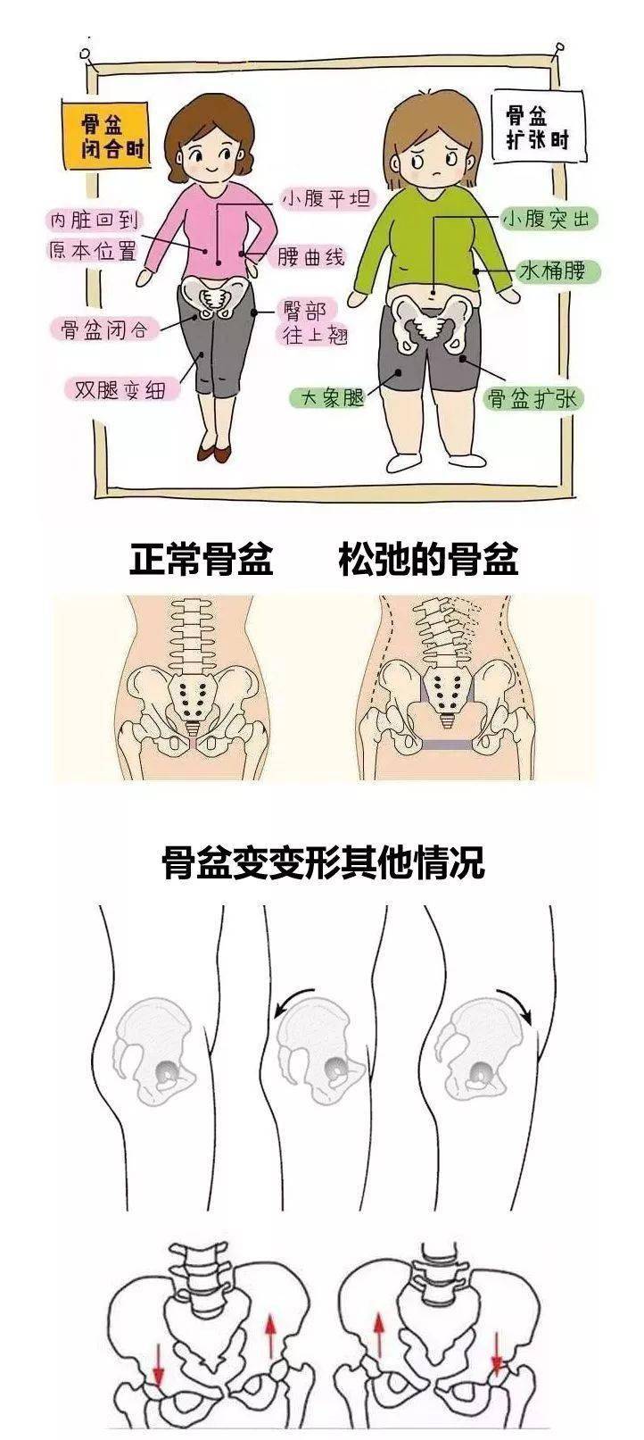 骨盆长度图片