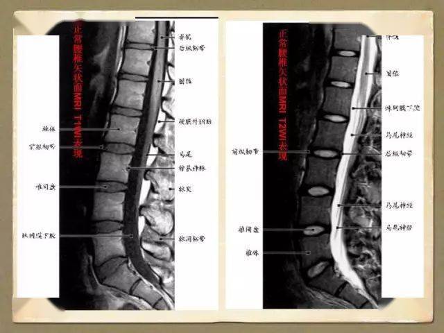 脊椎解剖与影像学(下)
