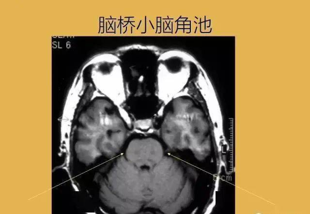 小脑池一个好的方法技巧一定源于一个好的理论知识