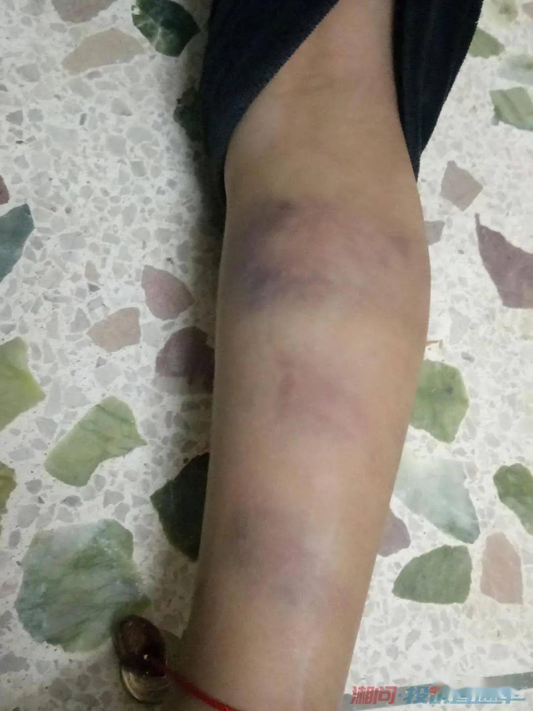 隆回一小学老师殴打学生事件的情况调查