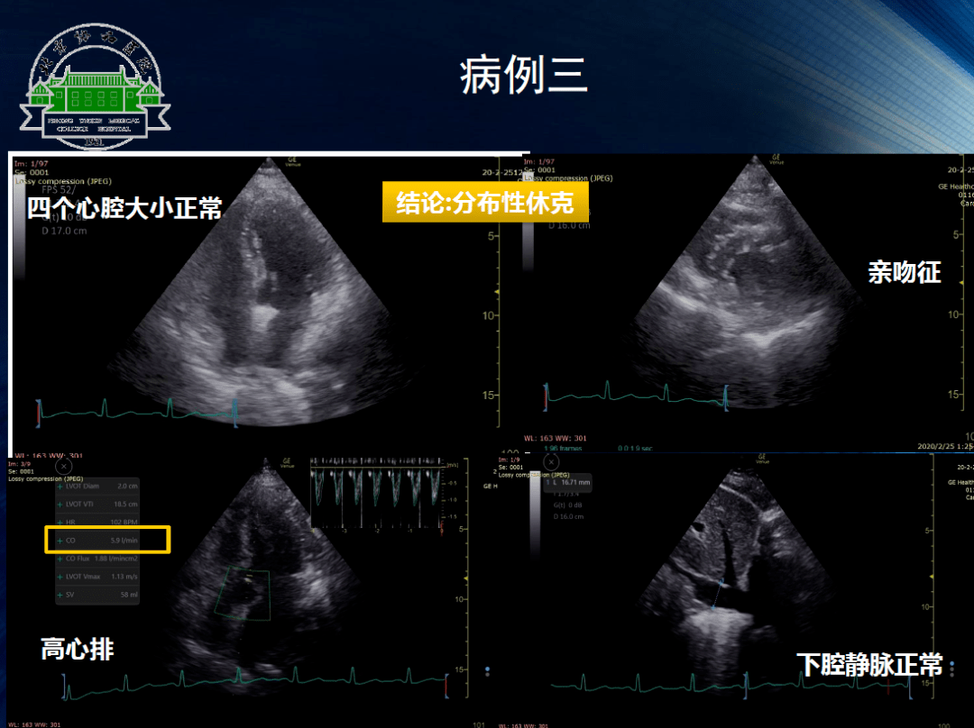 讲师简介|宋锴澄北京协和医院麻醉科主任助理,心血管麻醉亚专业组组长