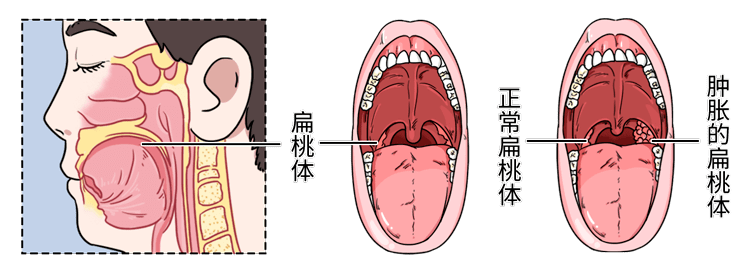 鼻呼吸vs嘴巴呼吸,人的顏值差距竟如此之大!後悔沒早點看到.