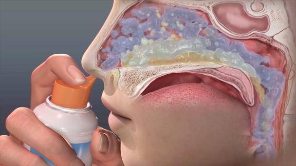 3d视频盐水洗鼻子真的有用吗