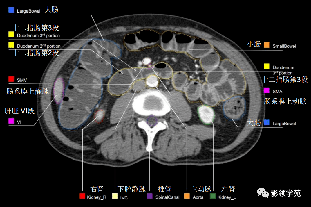 腹部影像学解剖图谱,拿走不谢!