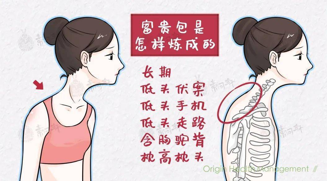 脖子上的出现这个富贵包其实是个夺命包再不重视就晚了