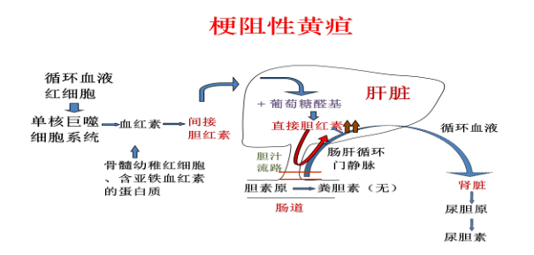 梗阻性黄疸患者一般皮肤暗黄伴瘙痒,尿色似浓茶,粪便颜色浅,胆道完全