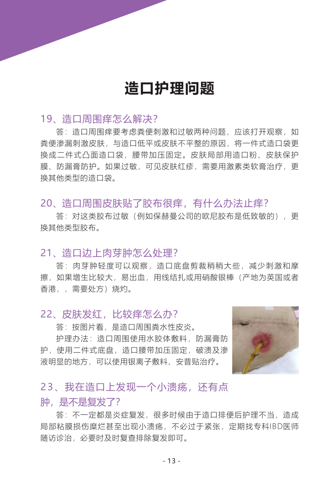 主任中医师孙红玲 浙江大学医学院附属第二医院伤口造口专科 副主任