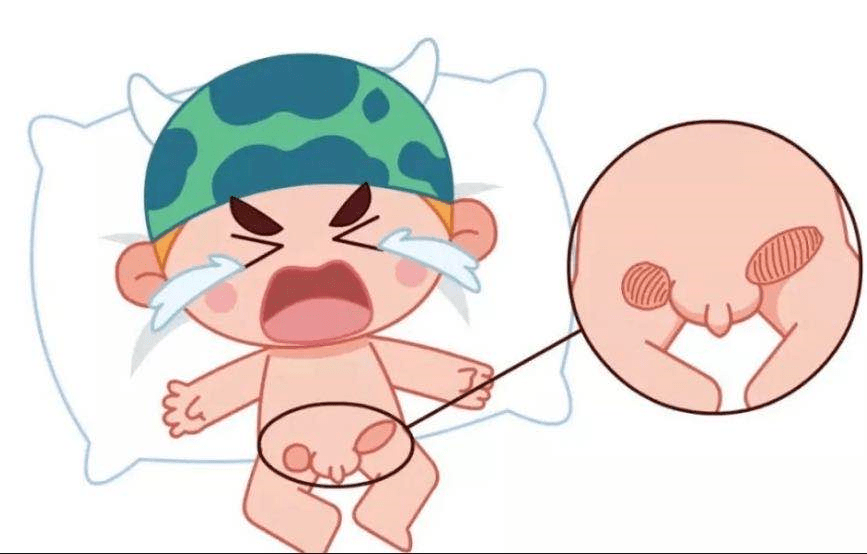 新生儿疝气的症状图片图片
