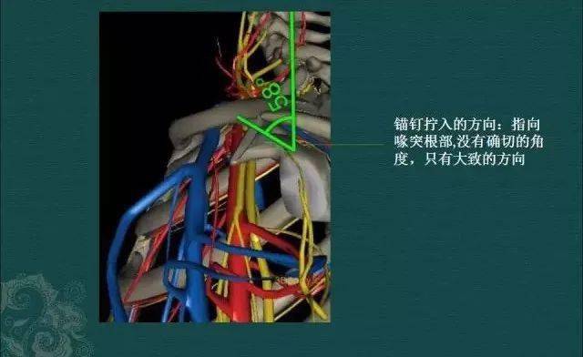 肩鎖關節脫位3個步驟9種治療方法