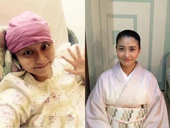 最典型的莫过于日本歌舞伎演员市川海老藏的妻子,女主播小林麻央罹患